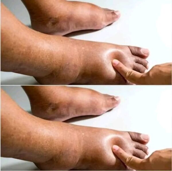 10 signes de l’AVC à surveiller chez les personnes qui vous sont chères