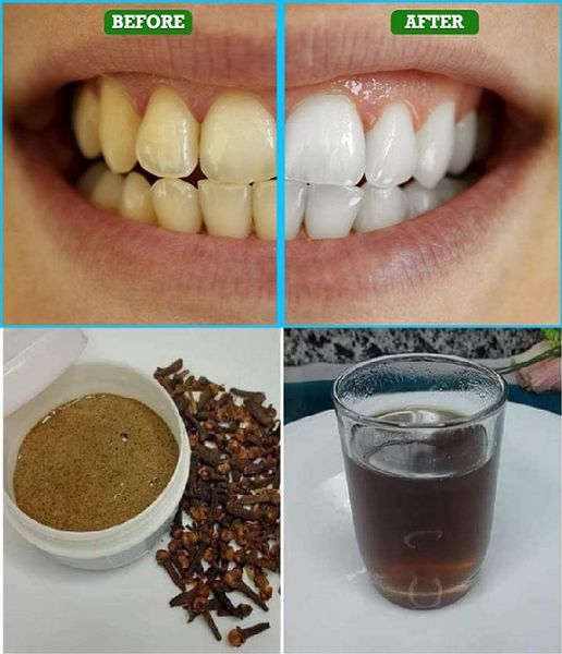 7 proven recipes that remove yellowing permanently