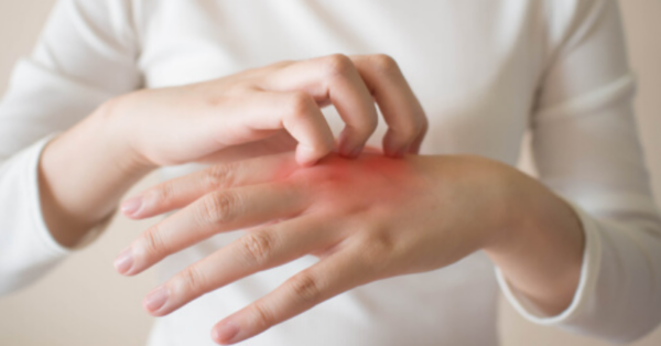 8 S.e.r.i.o.u.s Diseases That Are Signaled By Our Skin