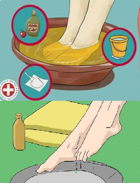 A Simple 10-Minute Method to Successfully Relieve Sciatic Nerve Pain