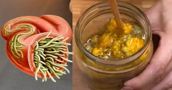 A Time-Tested Remedy: My Grandmother’s Natural Recipe to Banish Parasites, Worms, and Toxins