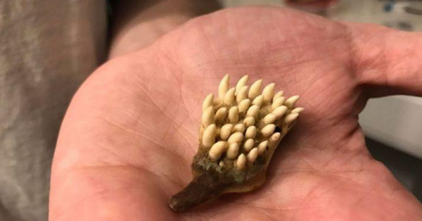 A man wakes up with small bubbles on his finger
