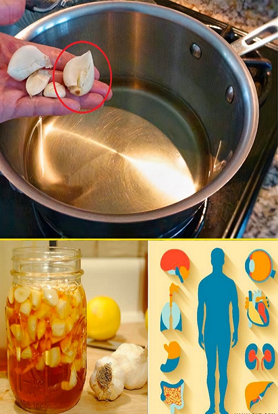 Boil 5 cloves of garlic in a large pot and then use it like this