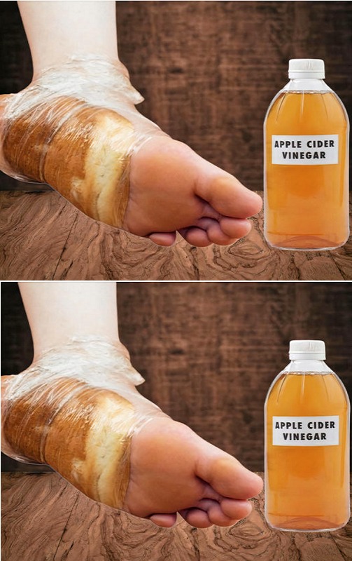 Discover Natural Solutions for Smooth, Summer-Ready Feet