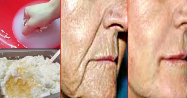 Do This Once A Week, And Say Goodbye To The Deep Wrinkles And Scars