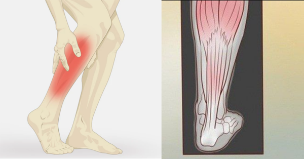 Do Your Legs Sometimes Cramp? Here is How to Stop it From Happening Ever Again