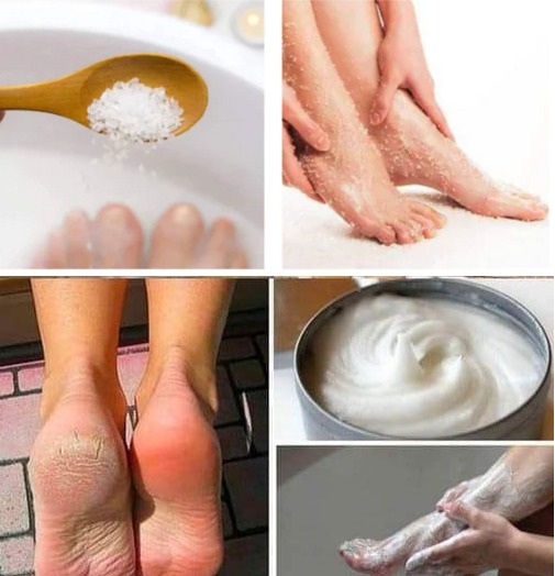 Here’s how to do a pedicure at home with baking soda