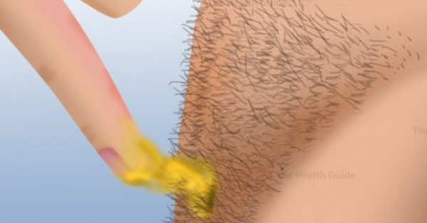 How To Remove Body Hair Permanently Without Any Waxing Or Shaving