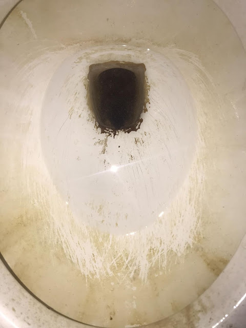 How To Remove Hard Water Stains From A Toilet Bowl