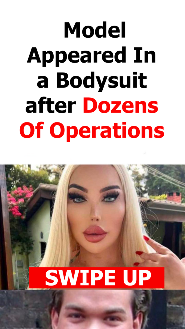 “I Am a Dream-Woman Of All Men”: The Model Who Underwent Dozens Of Operations Appeared In a Bodysuit!