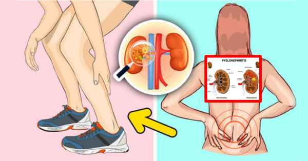 If your body has suffered from these things for a long time, don’t hesitate, get your kidneys checked immediately!