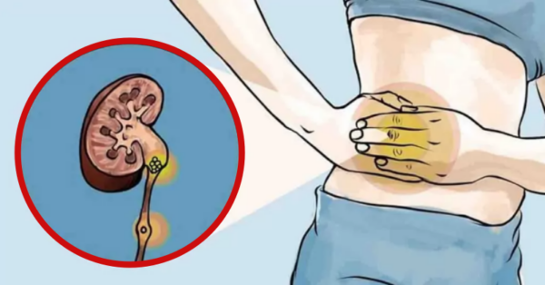 Never Ignore These 9 Symptoms of a Toxic Kidney