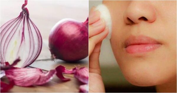 Onion benefits for skin: Top 5 Reasons Why Woman Should Rub Onion On Their Face
