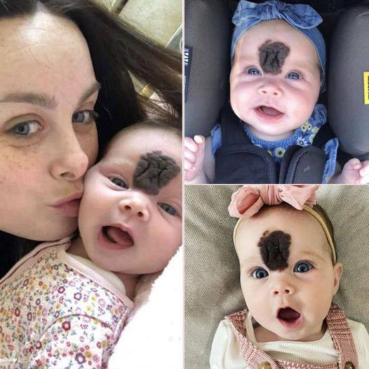 PARENTS KEEP THEIR BABY HIDDEN TO PROTECT HER FROM PEOPLE’S CURIOUS LOOKS. NOW, AT THE AGE OF TWO, SHE LOOKS STUNNING.