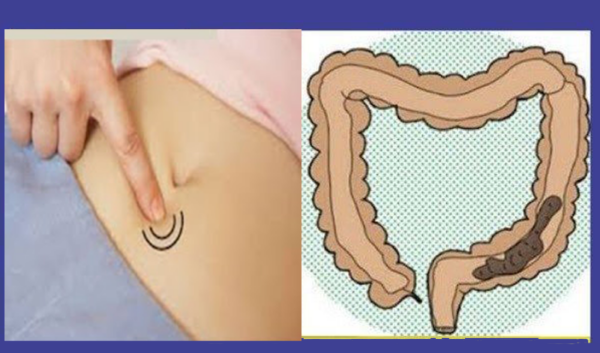 Press This Spot And You Will P.o.o.p Immediately!