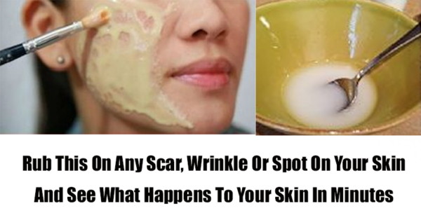 Rub This On Any Scar, Wrinkle Or Spot On Your Skin And See What Happens To Your Skin In Minutes