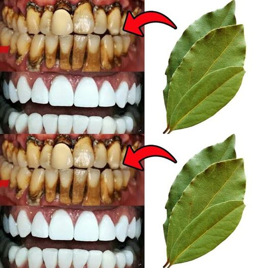 Secret that Dentists don’t want you to know.