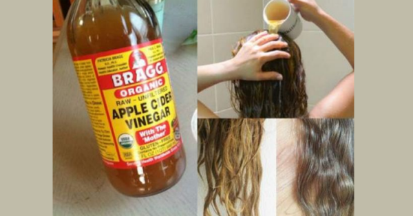 Sometimes wash your hair with a little apple cider vinegar mixed with lukewarm water to solve some of the biggest hair problems