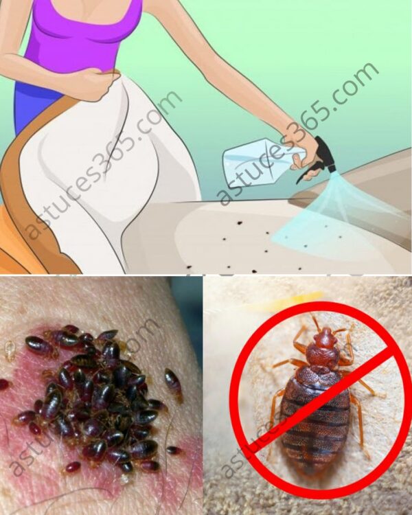 Spray Alcohol in Your Bed to Kill Bed Bugs