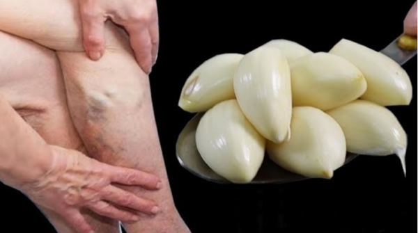 THIS ANCIENT REMEDY FROM THE PAST SOLVES A COMMON PROBLEM AMONG WOMEN