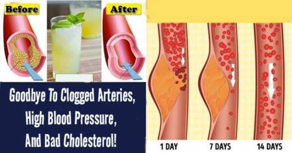 Take 4 Tablespoons Of This Every Morning And Say Goodbye To Clogged Arteries, High Blood Pressure, And Bad Cholesterol!
