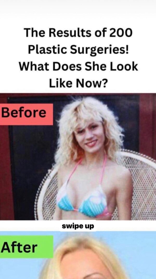 The Amazing Result of 200 Plastic Surgery Procedures