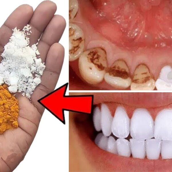 The Quick At-Home Teeth Whitening Secret