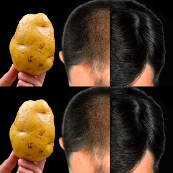 The Secret to Luxurious Hair: Potatoes