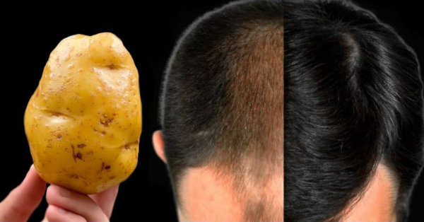 The Secret to Luxurious Hair: Potatoes