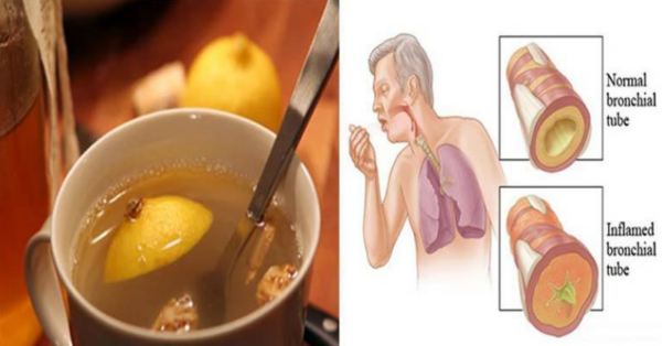 The natural remedy to remove the phlegm from the lungs and strengthen your immune system. Just 3 ingredients in your kitchen!