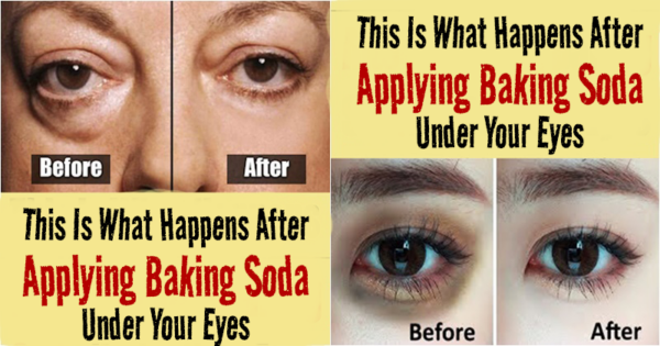 This Is What Happens After Applying Baking Soda Under Your Eyes