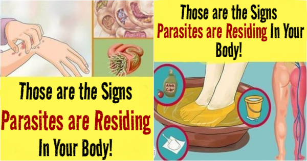 Those are the Signs Parasites are Residing In Your Body!