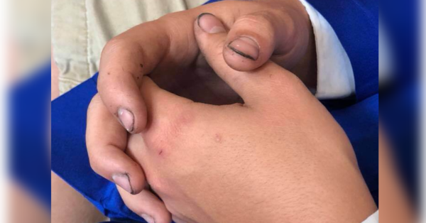 To the Mom Who Sent Her Son to Senior Pictures With Dirty Fingernails